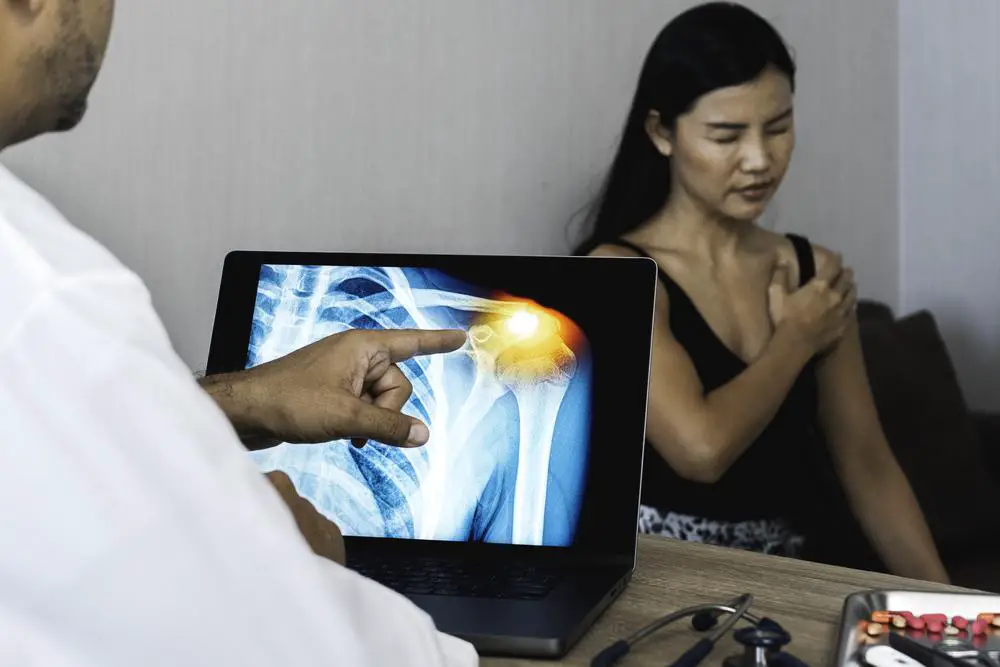 Doctor showing a x-ray of pain in the shoulder on a laptop. Woman patient holding her shoulder. High quality photo